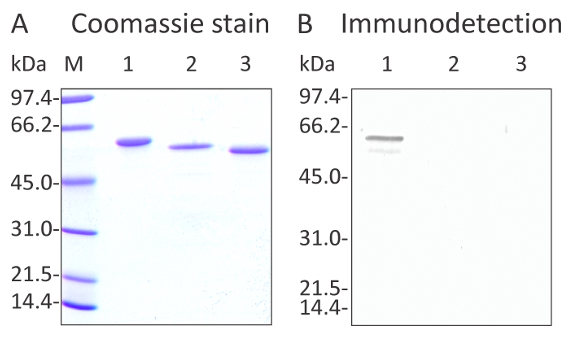 Western blot using anti-enolase antibodies